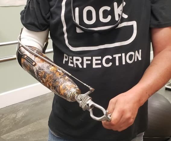 Trans-radial body-powered prosthetic